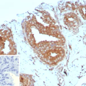 Formalin-fixed, paraffin-embedded human prostate stained with CD161 Mouse Monoclonal Antibody (KLRB1/8910). Inset: PBS instead of primary antibody; secondary only negative control.
