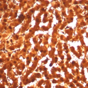 Formalin-fixed, paraffin-embedded human liver stained with Arginase 1 Recombinant Rabbit Monoclonal Antibody (ARG1/7514R). HIER: Tris/EDTA, pH9.0, 45min. 2°C: HRP-polymer, 30min. DAB, 5min.