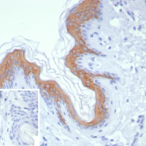 Formalin-fixed, paraffin-embedded human skin stained with Cytokeratin 1 Recombinant Rabbit Monoclonal Antibody (KRT1/8342R). Inset: PBS instead of primary antibody; secondary only negative control.