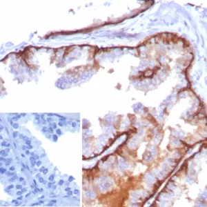Formalin-fixed, paraffin-embedded human tonsil stained with Cytokeratin 5 Recombinant Rabbit Monoclonal Antibody (KRT5/8814R). Inset: PBS instead of primary antibody; secondary only negative control.