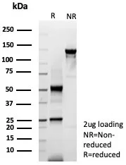 SDS-PAGE Analysis of Purified KRT6A Recombinant Mouse Monoclonal Antibody (rKRT6/9402). Confirmation of Purity and Integrity of Antibody.