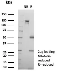 SDS-PAGE Analysis of Purified KRT6A Recombinant Rabbit Monoclonal Antibody (KRT6/8267R). Confirmation of Purity and Integrity of Antibody.
