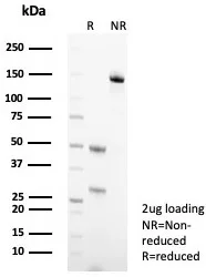 SDS-PAGE Analysis of Purified Keratin 10 Mouse Monoclonal Antibody (KRT10/3861). Confirmation of Purity and Integrity of Antibody.