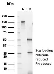 SDS-PAGE Analysis of Purified Keratin 10 Mouse Monoclonal Antibody (KRT14/6962). Confirmation of Purity and Integrity of Antibody.
