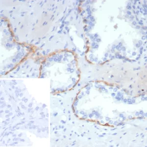 Formalin-fixed, paraffin-embedded human prostate stained with KRT14 Recombinant Mouse Monoclonal Antibody (rKRT14/7269). Inset: PBS instead of primary antibody; secondary only negative control.