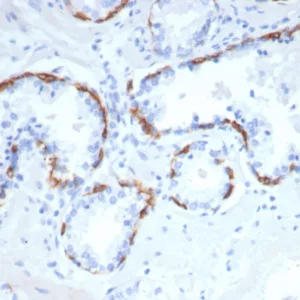 Formalin-fixed, paraffin-embedded human prostate stained with KRT14 Recombinant Mouse Monoclonal Antibody (rKRT14/7290). HIER: Tris/EDTA, pH9.0, 45min. 2°C: HRP-polymer, 30min. DAB, 5min.