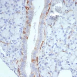 Formalin-fixed, paraffin-embedded human prostate stained with Cytokeratin 14 Recombinant Rabbit Monoclonal Antibody (KRT14/7047R). HIER: Tris/EDTA, pH9.0, 45min. 2°C: HRP-polymer, 30min. DAB, 5min.