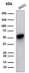 Western blot analysis of A431 cell lysate using Cytokeratin 14 Recombinant Rabbit Monoclonal Antibody (KRT14/7054R).