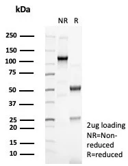 SDS-PAGE Analysis of Purified KRT14 Recombinant Rabbit Monoclonal Antibody (KRT14/6987R). Confirmation of Purity and Integrity of Antibody.