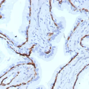 Formalin-fixed, paraffin-embedded human prostate stained with KRT14 Recombinant Rabbit Monoclonal Antibody (KRT14/7977R). HIER: Tris/EDTA, pH9.0, 45min. 2: HRP-polymer, 30min. DAB, 5min.
