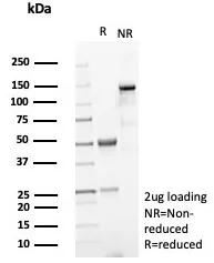 SDS-PAGE Analysis of Purified KRT15 Rabbit Recombinant Monoclonal Antibody (KRT15/8312R). Confirmation of Purity and Integrity of Antibody.