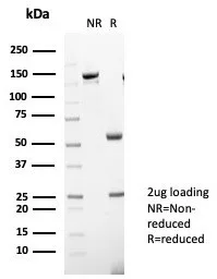 SDS-PAGE Analysis of Purified Interleukin-31 Mouse Monoclonal Antibody (IL31/7333). Confirmation of Purity and Integrity of Antibody.