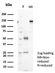 SDS-PAGE Analysis of Purified KRT19 Recombinant Rabbit Monoclonal Antibody (KRT19/8091R). Confirmation of Purity and Integrity of Antibody.