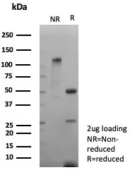 SDS-PAGE Analysis of Purified CD171 Recombinant Rabbit Monoclonal Antibody (L1CAM/9146R). Confirmation of Integrity and Purity of Antibody.