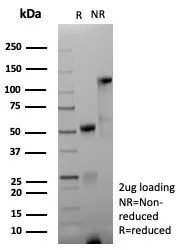 SDS-PAGE Analysis of Purified CD171 Recombinant Rabbit Monoclonal Antibody (L1CAM/9267R). Confirmation of Integrity and Purity of Antibody.
