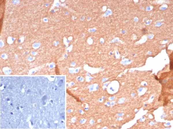 Formalin-fixed, paraffin-embedded human brain stained with CD171 Recombinant Rabbit Monoclonal Antibody (L1CAM/9267R). Inset: PBS instead of primary antibody; secondary only negative control.