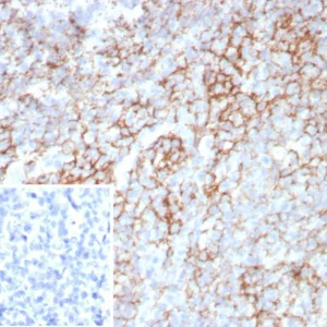 Formalin-fixed, paraffin-embedded human tonsil stained with LAG-3 Mouse Monoclonal Antibody (LAG3/7380). Inset: PBS instead of primary antibody; secondary only negative control.