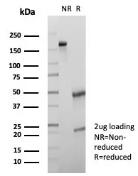 SDS-PAGE Analysis of Purified CD107a / LAMP1 Mouse Monoclonal Antibody (LAMP1/7456). Confirmation of Purity and Integrity of Antibody.