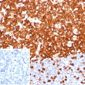 Formalin-fixed, paraffin-embedded human tonsil stained with Stathmin 1 Recombinant Rabbit Monoclonal Antibody (STMN1/8001R). Inset: PBS instead of primary antibody; secondary only negative control.