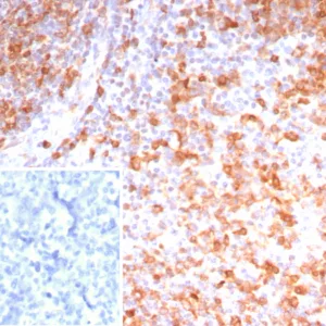Formalin-fixed, paraffin-embedded human tonsil stained with Stathmin 1 Recombinant Rabbit Monoclonal Antibody (STMN1/8023R). Inset: PBS instead of primary antibody; secondary only negative control.