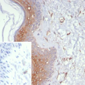Formalin-fixed, paraffin-embedded human skin stained with Galectin-3 Mouse Monoclonal Antibody (LGALS3/6583). Inset: PBS instead of primary antibody; secondary only negative control.