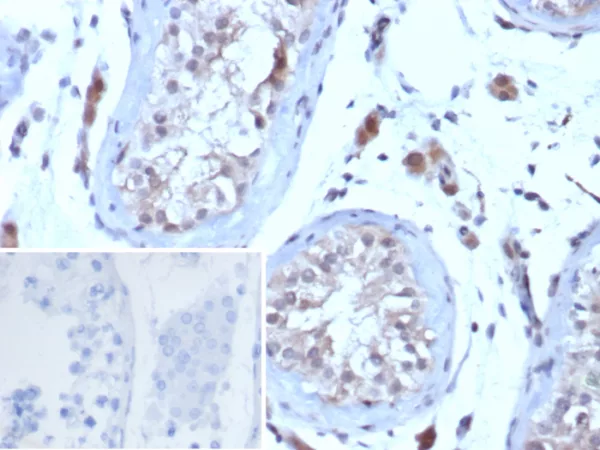 Formalin-fixed, paraffin-embedded human testis stained with  LHCGR Mouse Monoclonal Antibody (LHCGR/7398). Inset: PBS instead of primary antibody; secondary only negative control.