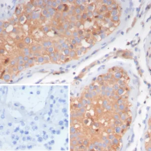 Formalin-fixed, paraffin-embedded human testis stained with  LHCGR Mouse Monoclonal Antibody (LHCGR/7399). Inset: PBS instead of primary antibody; secondary only negative control.