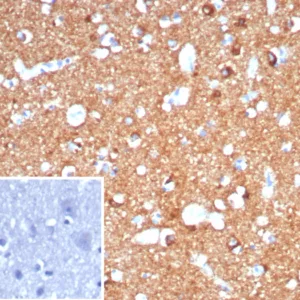 Formalin-fixed, paraffin-embedded human brain stained with CD91 / LRP1 Mouse Monoclonal Antibody (LRP1/7152) Inset: PBS instead of primary antibody; secondary only negative control.