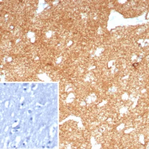Formalin-fixed, paraffin-embedded human brain stained with CD91 / LRP1 Recombinant Rabbit Monoclonal Antibody (LRP1/8771R). Inset: PBS instead of primary antibody; secondary only negative control.