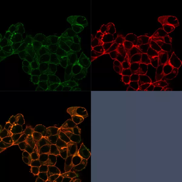 Immunofluorescence Analysis of PFA-fixed MCF-7 cells stained using Lactotransferrin Mouse Monoclonal Antibody (LTF/4074) followed by goat anti-mouse IgG-CF488 (green). CF640A phalloidin (red).