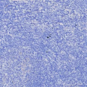 IHC analysis of formalin-fixed, paraffin-embedded human tonsil. Negative tissue control using EGP40/8130R at 2ug/ml in PBS for 30min RT.  HIER: Tris/EDTA, pH9.0, 45min. 2: HRP-polymer, 30min. DAB, 5min.