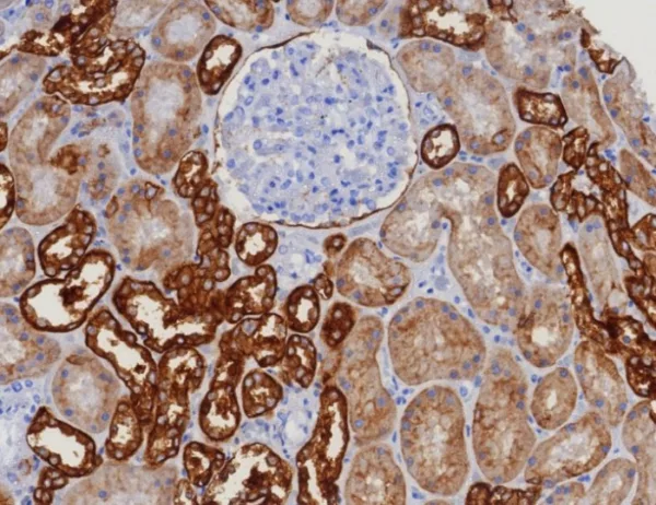 IHC analysis of formalin-fixed, paraffin-embedded human kidney. Negative tissue control using EGP40/8130R at 2ug/ml in PBS for 30min RT.  HIER: Tris/EDTA, pH9.0, 45min. 2: HRP-polymer, 30min. DAB, 5min.