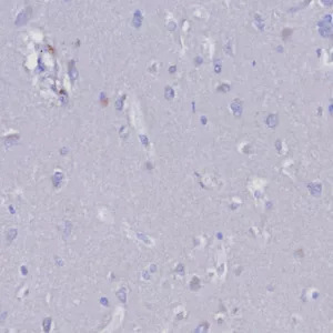 IHC analysis of formalin-fixed, paraffin-embedded human tonsil. Negative tissue control using EGP40/8191R at 2ug/ml in PBS for 30min RT.  HIER: Tris/EDTA, pH9.0, 45min. 2: HRP-polymer, 30min. DAB, 5min.