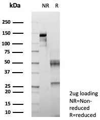 SDS-PAGE Analysis of Purified SMAD4 Mouse Monoclonal Antibody (SMAD4/7903). Confirmation of Purity and Integrity of Antibody.