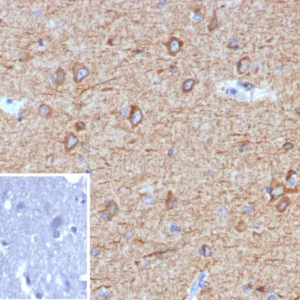 Formalin-fixed, paraffin-embedded human brain stained with MAP2 Mouse Monoclonal Antibody (MAP2/7673). Inset: PBS instead of primary antibody; secondary only negative control.