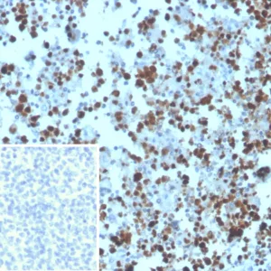 Formalin-fixed, paraffin-embedded human tonsil stained with MCM3 Mouse Monoclonal Antibody (MCM3/3221). Inset: PBS instead of primary antibody, secondary only control.