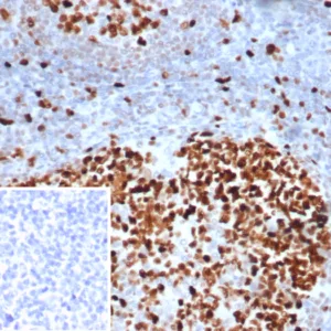 Formalin-fixed, paraffin-embedded human tonsil stained with MCM3 Mouse Monoclonal Antibody (MCM3/6706). Inset: PBS instead of primary antibody, secondary only control.