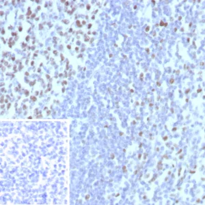 Formalin-fixed, paraffin-embedded human tonsil stained with MCM3 Recombinant Rabbit Monoclonal Antibody (MCM3/8972R). Inset: PBS instead of primary antibody, secondary only control.