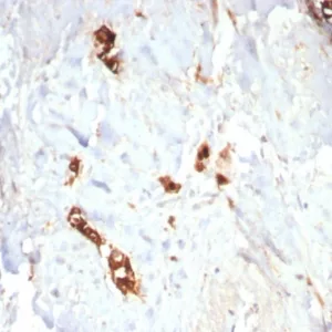 Formalin-fixed, paraffin-embedded human lactating breast stained with Mammaglobin Recombinant Rabbit Monoclonal Antibody (MGB/7980R). HIER: Tris/EDTA, pH9.0, 45min. 2°C: HRP-polymer, 30min. DAB, 5min.