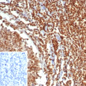 Formalin-fixed, paraffin-embedded human testis stained with MGMT Mouse Monoclonal Antibody (MGMT/7454). Inset: PBS instead of primary antibody; secondary only negative control.