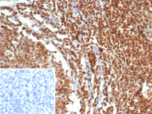 Formalin-fixed, paraffin-embedded human testis stained with MGMT Mouse Monoclonal Antibody (MGMT/7454). Inset: PBS instead of primary antibody; secondary only negative control.