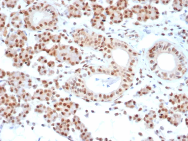 Formalin-fixed, paraffin-embedded human salivary gland stained with MGMT Mouse Monoclonal Antibody (MGMT/7454). HIER: Tris/EDTA, pH9.0, 45min. 2°C: HRP-polymer, 30min. DAB, 5min.