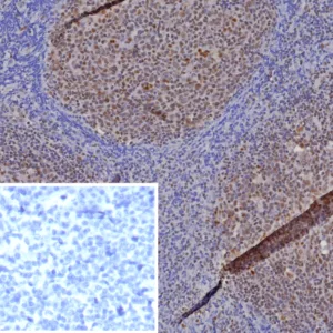 Formalin-fixed, paraffin-embedded human tonsil stained with MGMT Mouse Monoclonal Antibody (MGMT/8364R). HIER: Tris/EDTA, pH9.0, 45min. 2: HRP-polymer, 30min. DAB, 5min.