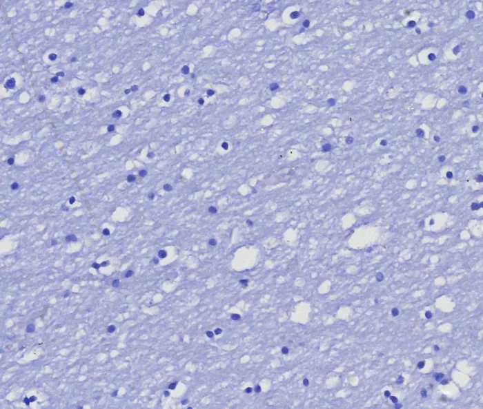 IHC analysis of formalin-fixed, paraffin-embedded human brain. Negative tissue control using MGMT/8364R at 2ug/ml in PBS for 30min RT. HIER: Tris/EDTA, pH9.0, 45min. 2: HRP-polymer, 30min. DAB, 5min. Recombinant MGMT (Marker of Suppressor of Mutation and Carcinogenesis) Antibody - Image 3