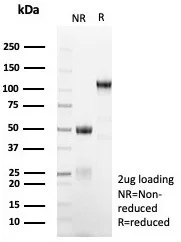 SDS-PAGE Analysis of Purified MGMT Mouse Monoclonal Antibody (MGMT/8364R). Confirmation of Purity and Integrity of Antibody. Recombinant MGMT (Marker of Suppressor of Mutation and Carcinogenesis) Antibody - Image 4