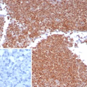Formalin-fixed, paraffin-embedded human lymph node stained with MGMT Mouse Monoclonal Antibody (MGMT/8186R). HIER: Tris/EDTA, pH9.0, 45min. 2°C: HRP-polymer, 30min. DAB, 5min.