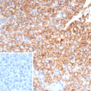 Formalin-fixed, paraffin-embedded human pancreas stained with  CD99 Mouse Monoclonal Antibody (MIC2/7862). Inset: PBS instead of primary antibody; secondary only negative control.