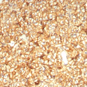 Formalin-fixed, paraffin-embedded human pancreas stained with  CD99 Mouse Monoclonal Antibody (MIC2/7864). HIER: Tris/EDTA, pH9.0, 45min. 2°C: HRP-polymer, 30min. DAB, 5min.