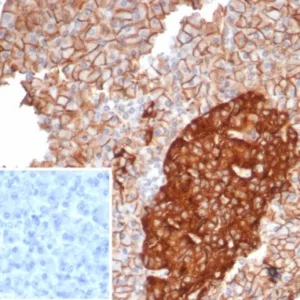 Formalin-fixed, paraffin-embedded human pancreas stained with  CD99 Mouse Monoclonal Antibody (MIC2/7865). Inset: PBS instead of primary antibody; secondary only negative control.