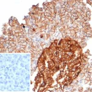 Formalin-fixed, paraffin-embedded human pancreas stained with  CD99 Mouse Monoclonal Antibody (MIC2/7866). Inset: PBS instead of primary antibody; secondary only negative control.